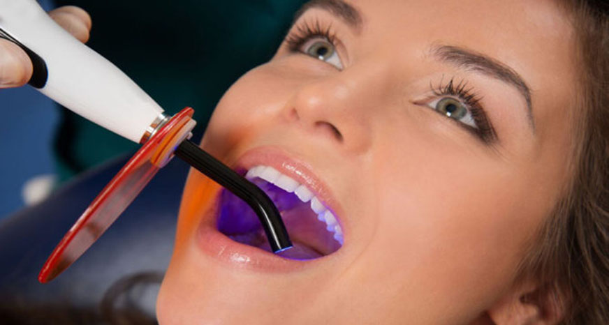 odontoiatria conservativa dentista roma